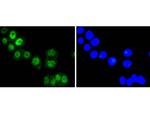 FOXO3A Recombinant Rabbit Monoclonal Antibody (SP0054)