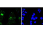 Survivin Recombinant Rabbit Monoclonal Antibody (SP07-06)