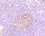 Survivin Antibody in Immunohistochemistry (Paraffin) (IHC (P))