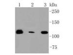RNF20 Recombinant Rabbit Monoclonal Antibody (SP00-47)