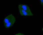 Phospho-JAK2 (Tyr1007, Tyr1008) Recombinant Rabbit Monoclonal Antibody (SY24-03)