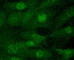 JAK2 Recombinant Rabbit Monoclonal Antibody (SY0245)