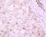 H4K20me3 Antibody in Immunohistochemistry (Paraffin) (IHC (P))