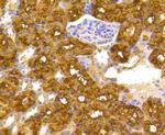 ATP Citrate Lyase Antibody in Immunohistochemistry (Paraffin) (IHC (P))