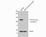 ATP Citrate Lyase Antibody in Western Blot (WB)