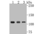 ATP Citrate Lyase Antibody in Western Blot (WB)