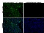 CD117 (c-Kit) Recombinant Rabbit Monoclonal Antibody (ST04-99)