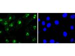 H3R2me1 Recombinant Rabbit Monoclonal Antibody (ST0427)