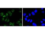 NBS1 Antibody in Immunocytochemistry (ICC/IF)