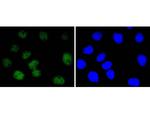 NBS1 Recombinant Rabbit Monoclonal Antibody (SC05-68)