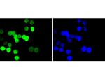 H2BK20ac Antibody in Immunocytochemistry (ICC/IF)