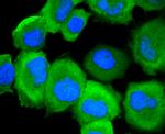 Phospho-EGFR (Ser695) Antibody in Immunocytochemistry (ICC/IF)