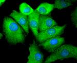 Phospho-EGFR (Ser695) Antibody in Immunocytochemistry (ICC/IF)
