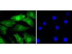 Cyclin E2 Recombinant Rabbit Monoclonal Antibody (SD2035)