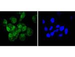 Cyclin E2 Antibody in Immunocytochemistry (ICC/IF)