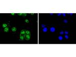 Cyclin E2 Antibody in Immunocytochemistry (ICC/IF)