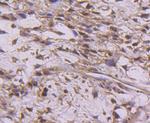 Cyclin E2 Antibody in Immunohistochemistry (Paraffin) (IHC (P))