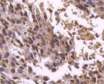 Histone H2B Antibody in Immunohistochemistry (Paraffin) (IHC (P))