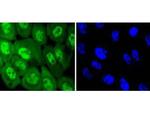 Phospho-EGFR (Tyr1068) Antibody in Immunocytochemistry (ICC/IF)