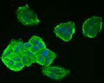 Tau Antibody in Immunocytochemistry (ICC/IF)