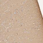 Tau Antibody in Immunohistochemistry (Paraffin) (IHC (P))