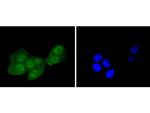 IRS1 Recombinant Rabbit Monoclonal Antibody (SD2046)