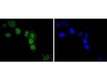 IRF2 Recombinant Rabbit Monoclonal Antibody (JJ088-0)