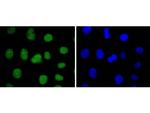 SUZ12 Recombinant Rabbit Monoclonal Antibody (JJ09-04)