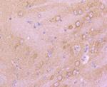 mGluR2 Antibody in Immunohistochemistry (Paraffin) (IHC (P))