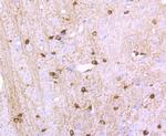NMDAR1 Recombinant Rabbit Monoclonal Antibody (JM11-26)
