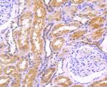 EGF Recombinant Rabbit Monoclonal Antibody (JA14-15)