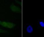 PDCD4 Recombinant Rabbit Monoclonal Antibody (JA80-83)