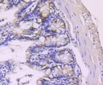 PDCD4 Antibody in Immunohistochemistry (Paraffin) (IHC (P))