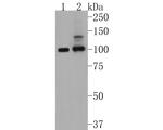 PSD93 Recombinant Rabbit Monoclonal Antibody (JM41-04)