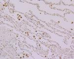 Nucleostemin Antibody in Immunohistochemistry (Paraffin) (IHC (P))