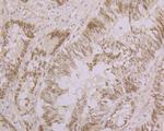 Nucleostemin Antibody in Immunohistochemistry (Paraffin) (IHC (P))