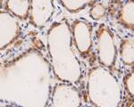 ICAD Antibody in Immunohistochemistry (Paraffin) (IHC (P))