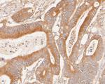 Phospho-c-Met (Tyr1349) Antibody in Immunohistochemistry (Paraffin) (IHC (P))