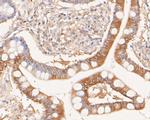 Phospho-c-Met (Tyr1349) Antibody in Immunohistochemistry (Paraffin) (IHC (P))
