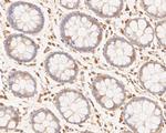 Phospho-c-Met (Tyr1349) Antibody in Immunohistochemistry (Paraffin) (IHC (P))