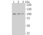 CTNNA3 Antibody in Western Blot (WB)