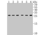 GTF2F2 Antibody in Western Blot (WB)