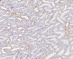 GTF2I Antibody in Immunohistochemistry (Paraffin) (IHC (P))
