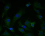 PGD Recombinant Rabbit Monoclonal Antibody (JE56-26)