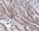 CIRBP Antibody in Immunohistochemistry (Paraffin) (IHC (P))