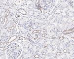 CIRBP Antibody in Immunohistochemistry (Paraffin) (IHC (P))