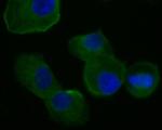 FADS1 Recombinant Rabbit Monoclonal Antibody (JE55-63)