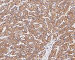 FADS1 Antibody in Immunohistochemistry (Paraffin) (IHC (P))