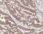 FADS1 Antibody in Immunohistochemistry (Paraffin) (IHC (P))