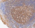 CC2D1A Antibody in Immunohistochemistry (Paraffin) (IHC (P))